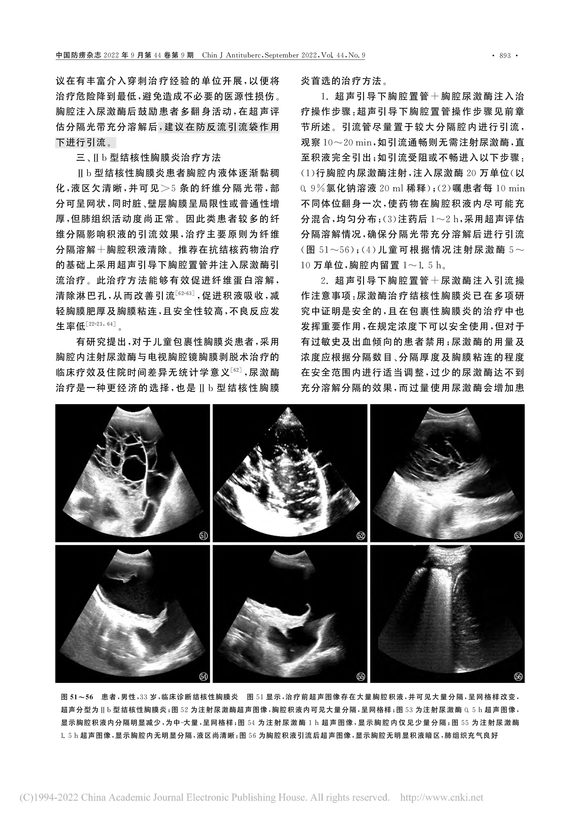 2022結(jié)核性胸膜炎超聲診斷、分型及介入治療專(zhuān)家共識(shí)(2022年版)-14.jpg