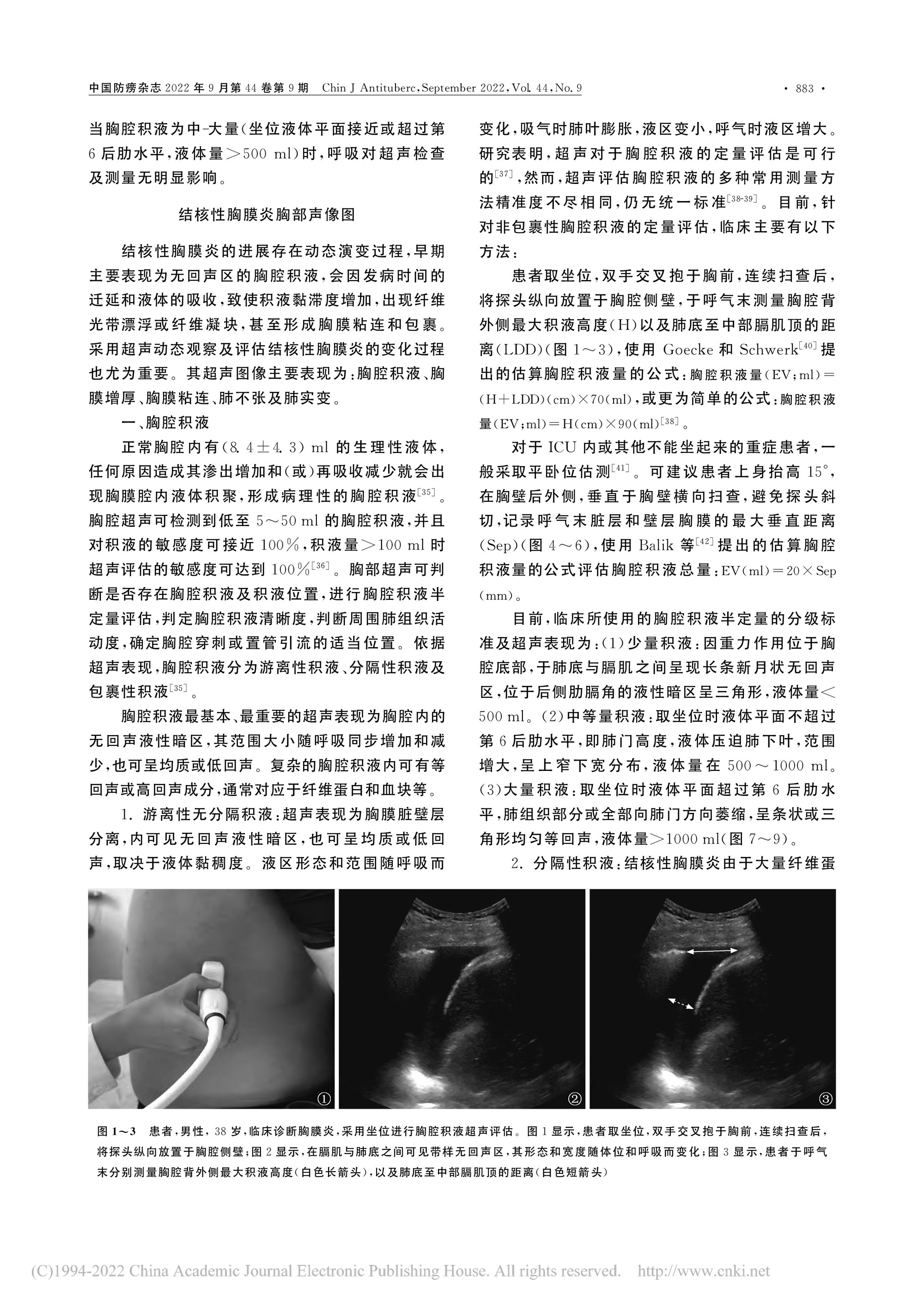 2022結(jié)核性胸膜炎超聲診斷、分型及介入治療專(zhuān)家共識(shí)(2022年版)-4.jpg