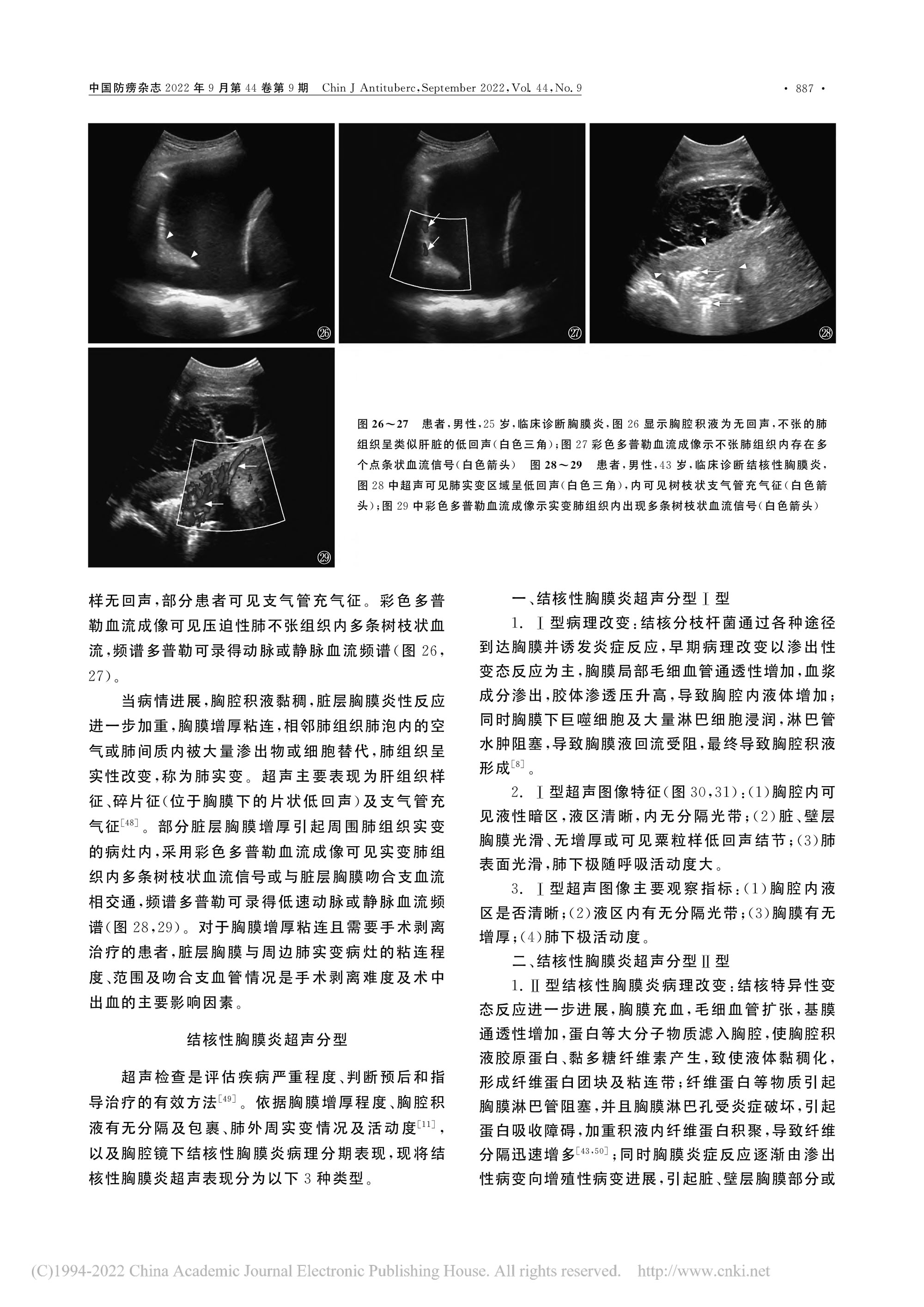 2022結(jié)核性胸膜炎超聲診斷、分型及介入治療專(zhuān)家共識(shí)(2022年版)-8.jpg