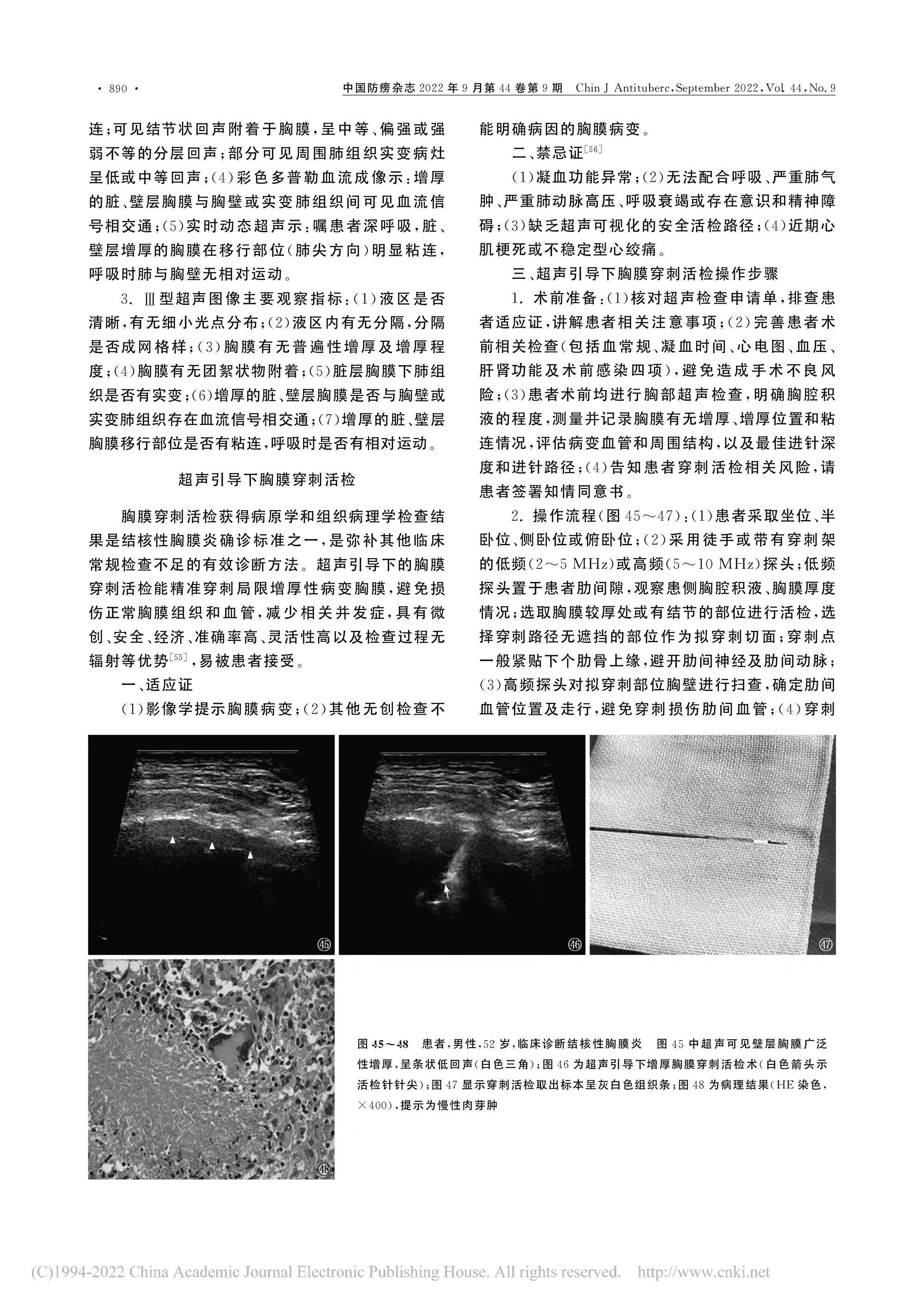 2022結(jié)核性胸膜炎超聲診斷、分型及介入治療專(zhuān)家共識(shí)(2022年版)-11.jpg
