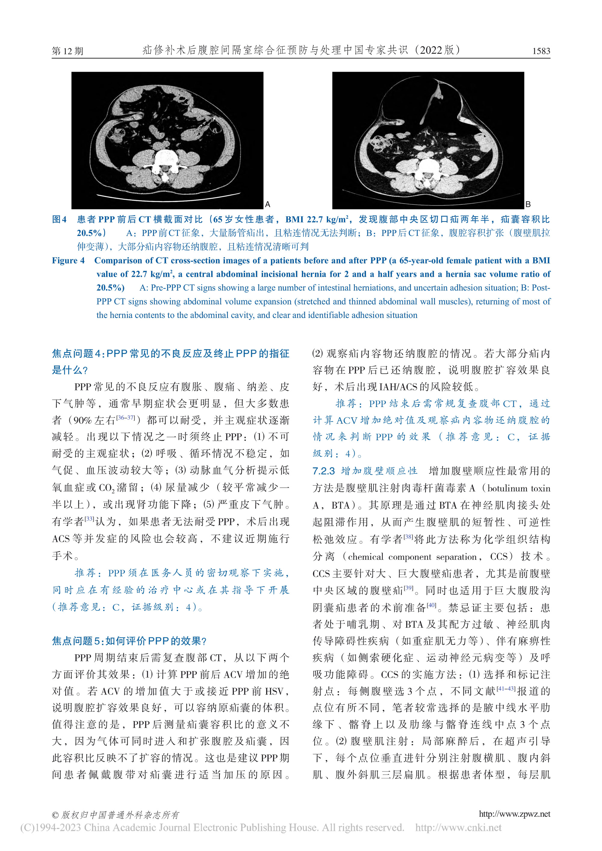 2022-疝修補(bǔ)術(shù)后腹腔間隔室綜合征預(yù)防與處理中國專家共識-6.jpg