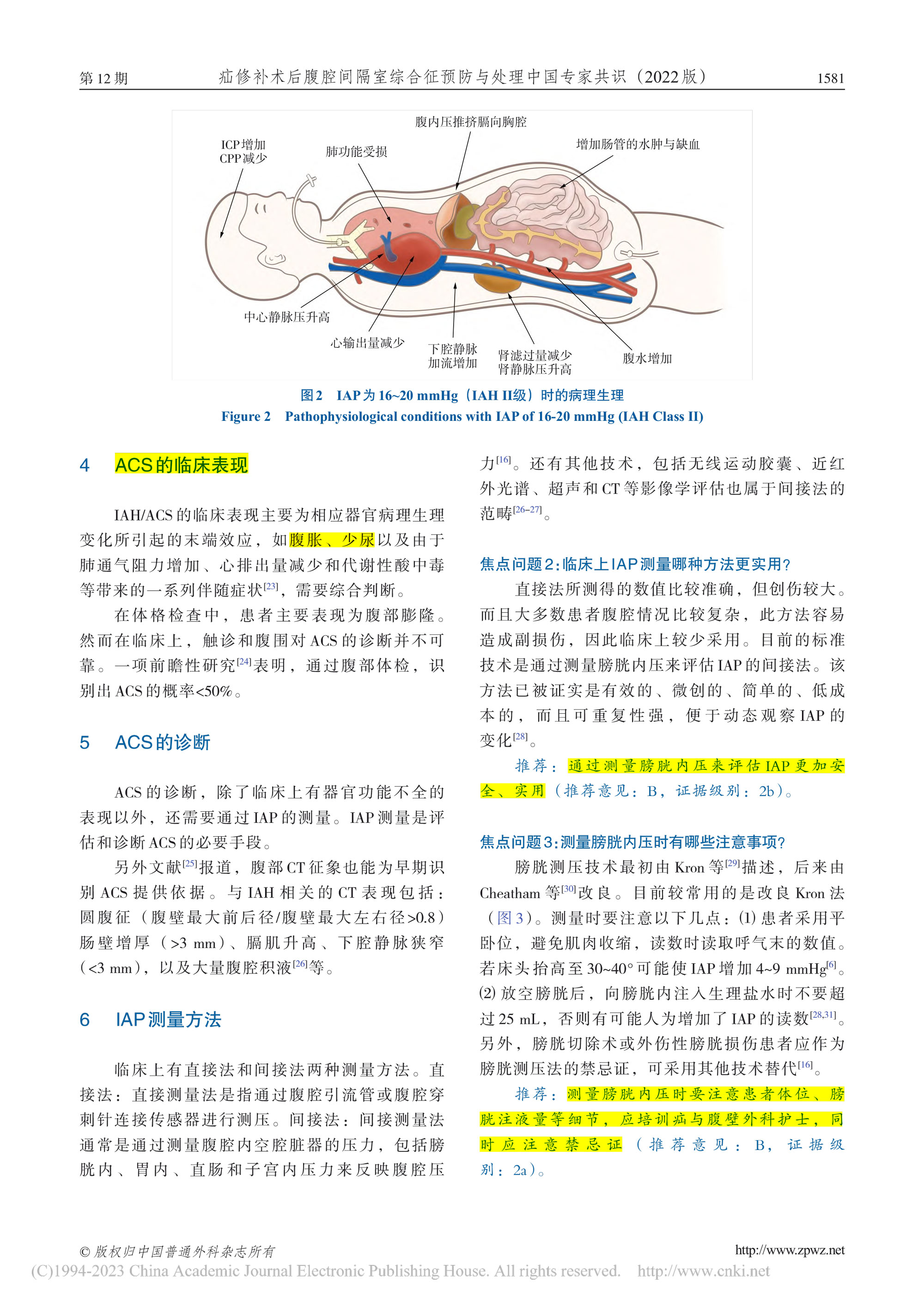 2022-疝修補(bǔ)術(shù)后腹腔間隔室綜合征預(yù)防與處理中國專家共識-4.jpg